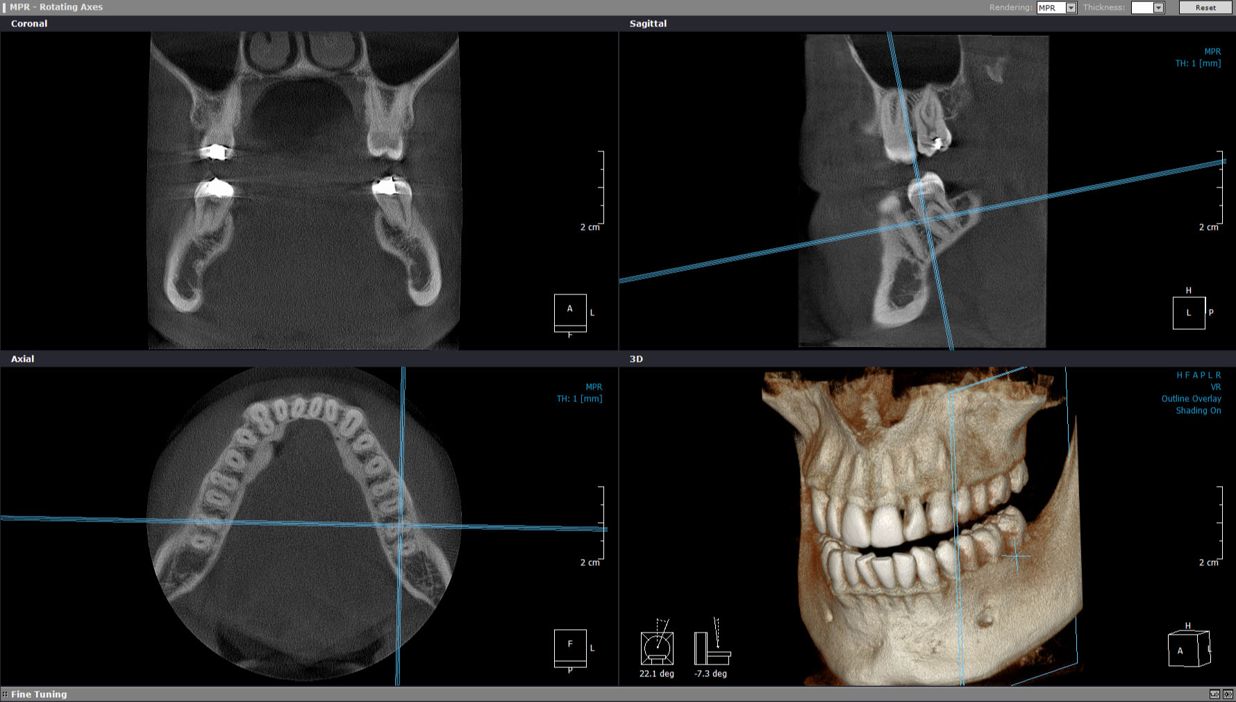 Technology - Allied Endodontics